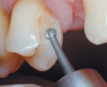 Richa Dental